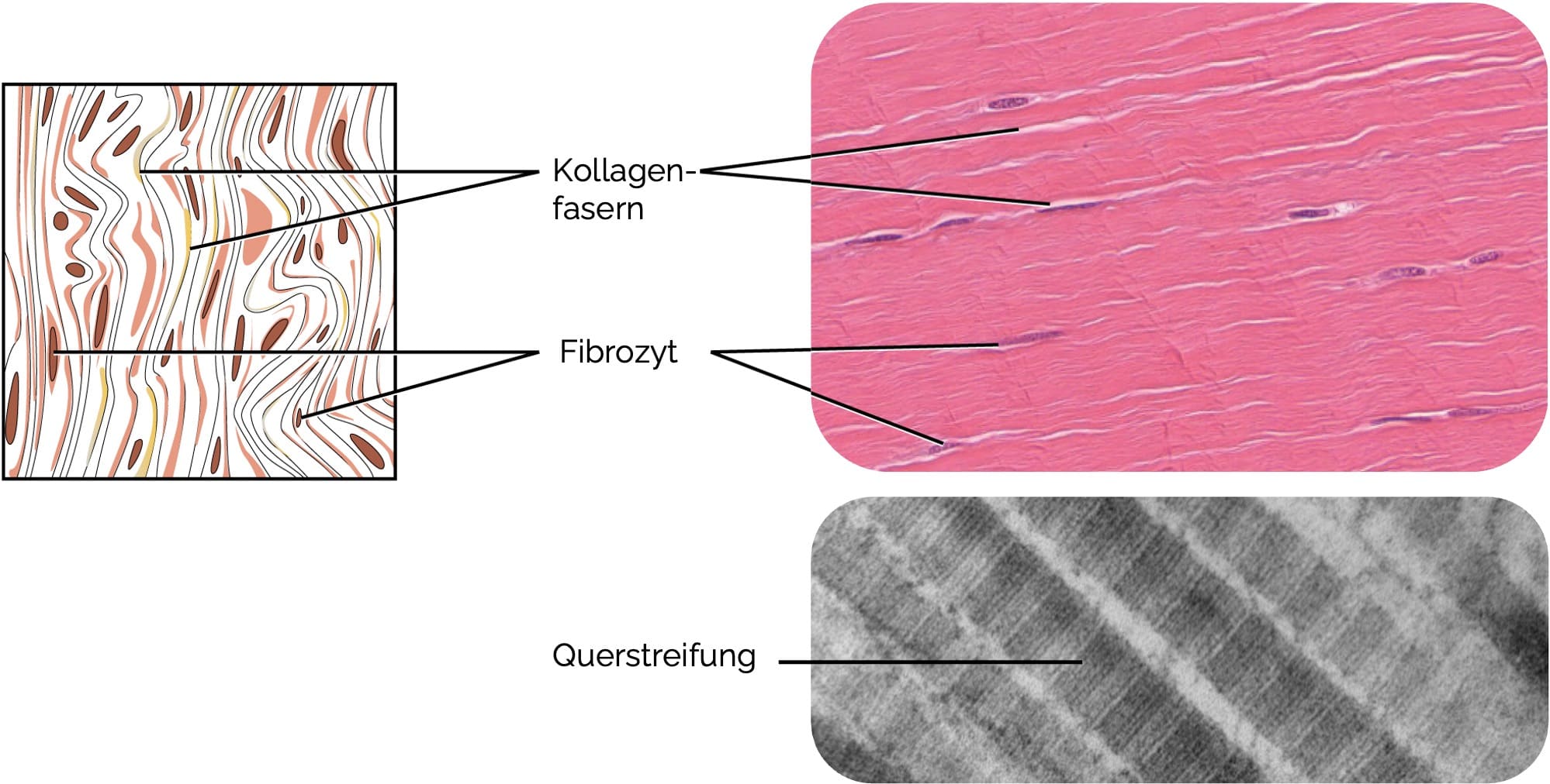 Straffes parallelfaseriges Bindegewebe