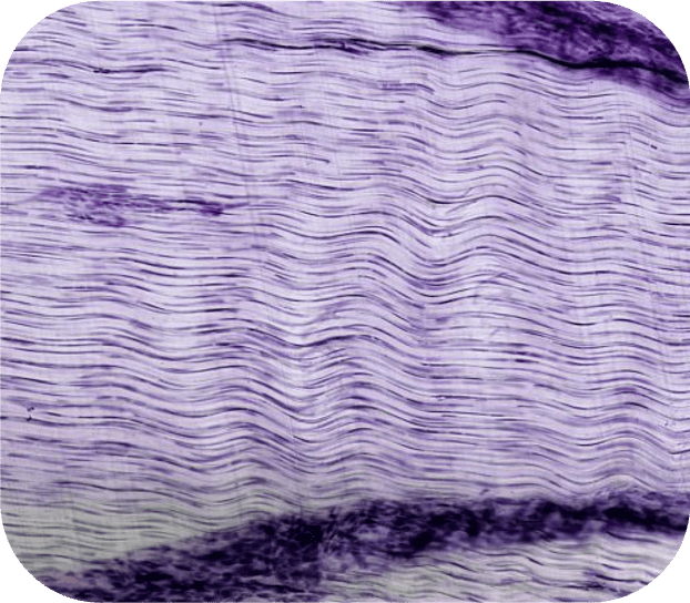 Straffes parallelfasriges Bindegewebe