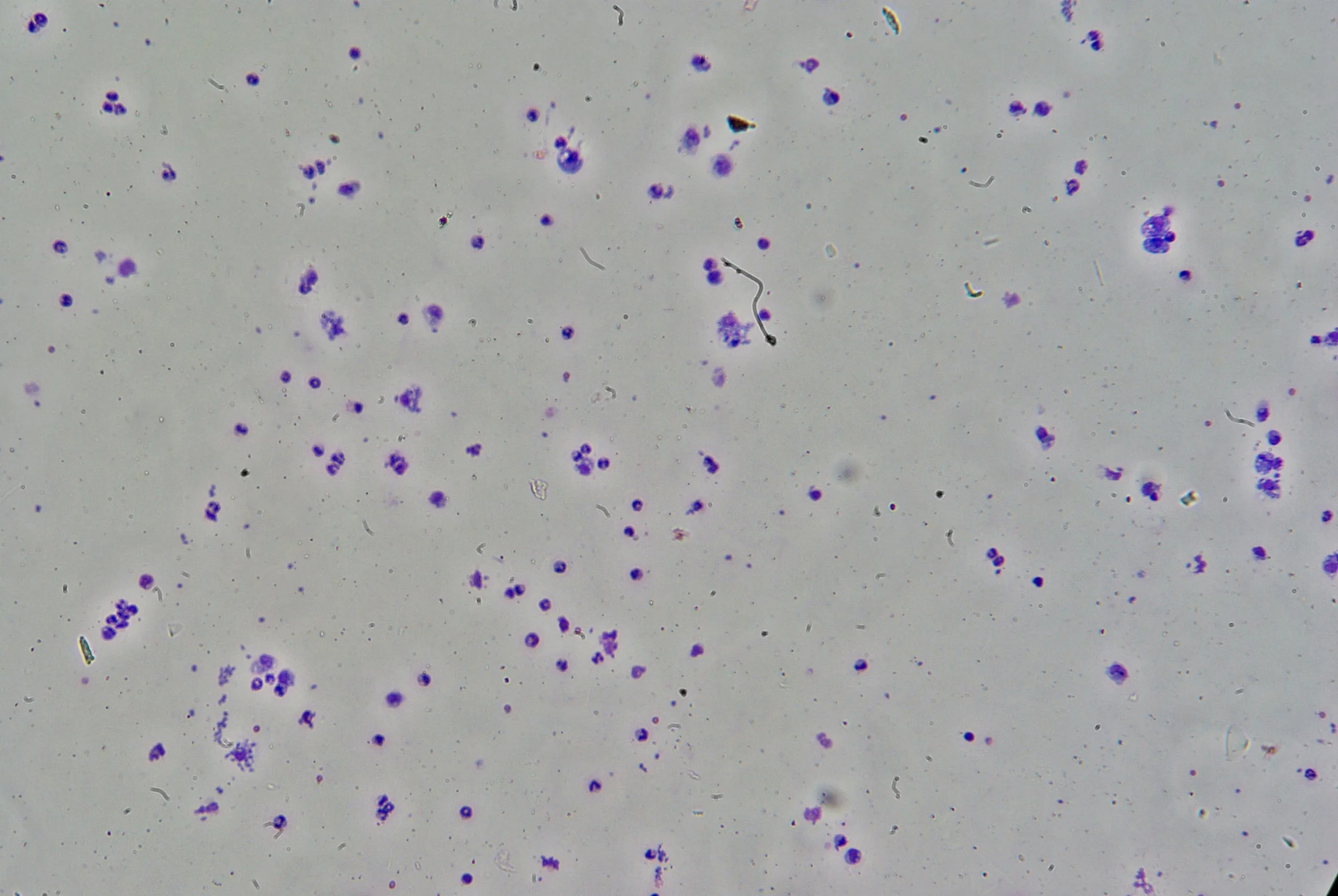 Toxoplasma gondii Ausstrich
