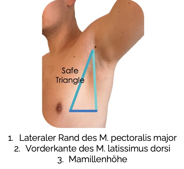Triangle of Safety