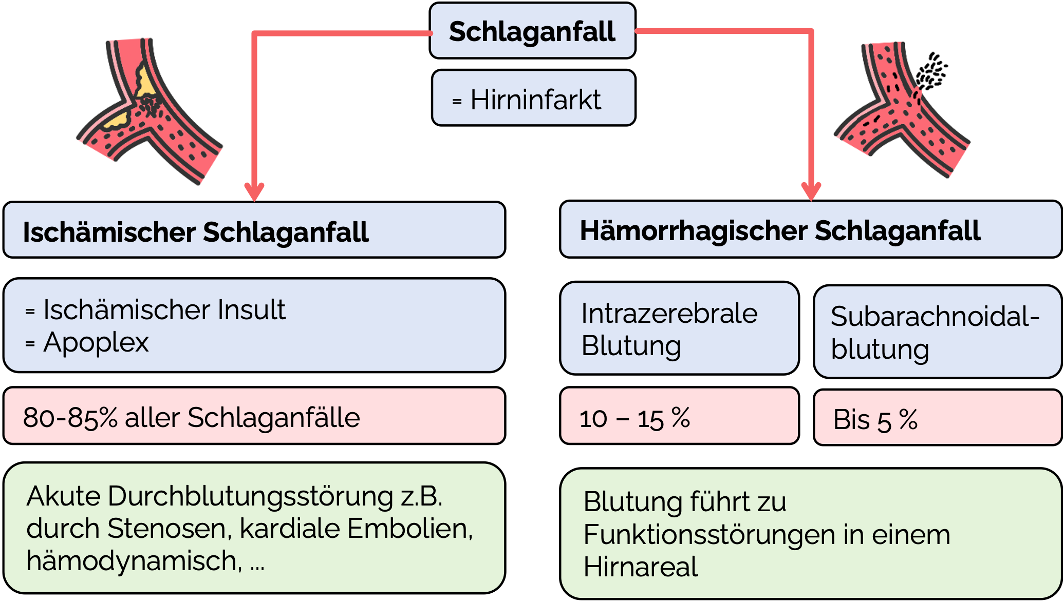 Schlaganfall: Einteilung Ischämisch und Hämorrhagisch