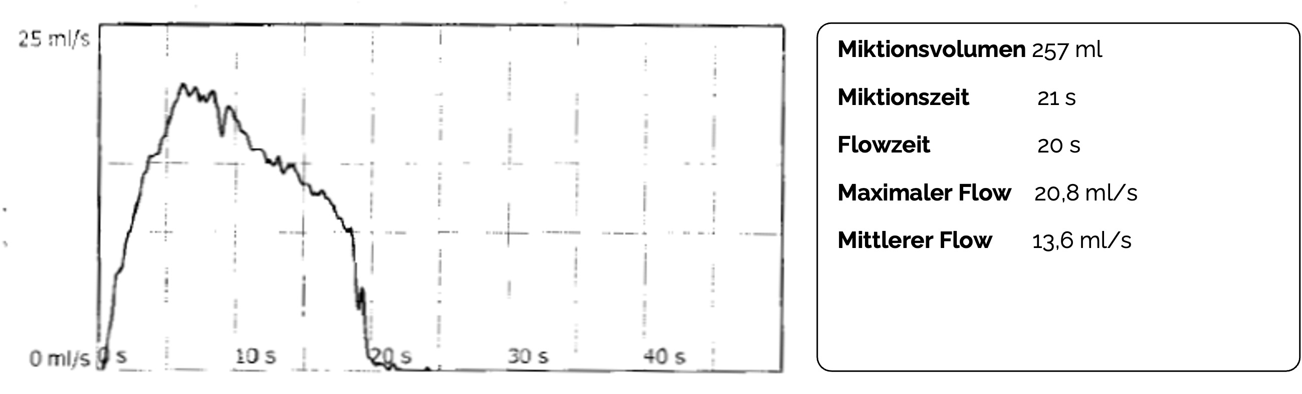 Uroflowmetrie mit normaler Harnflussrate