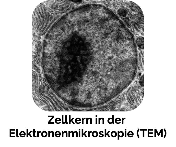 Zellkern in der Elektronenmikroskopie (TEM)