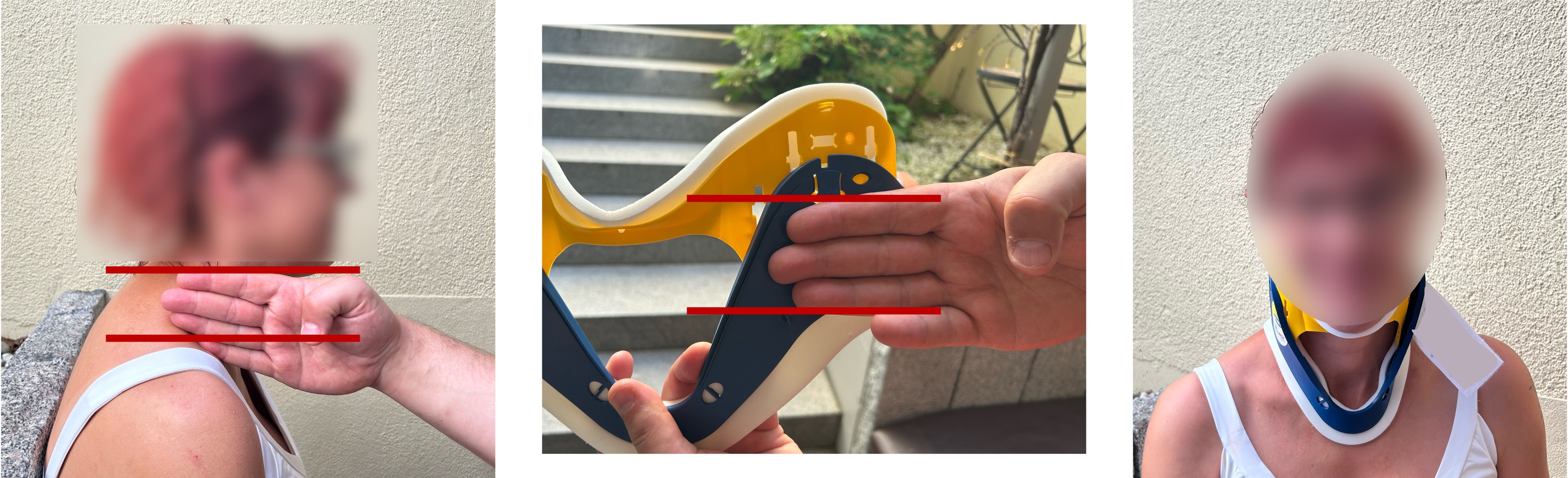 Anlage Zervikalstütze