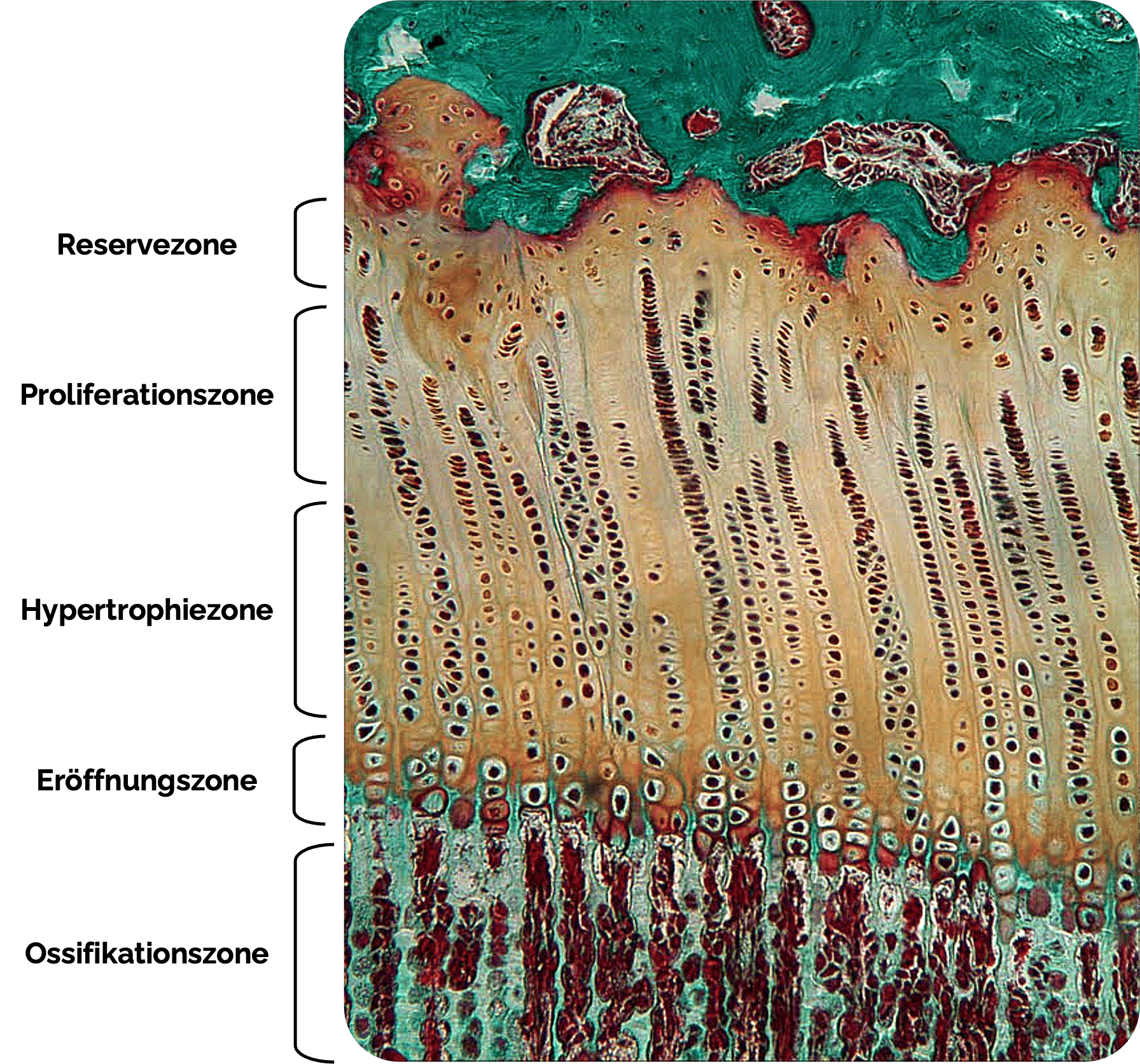 Zonen des Knochenwachstums