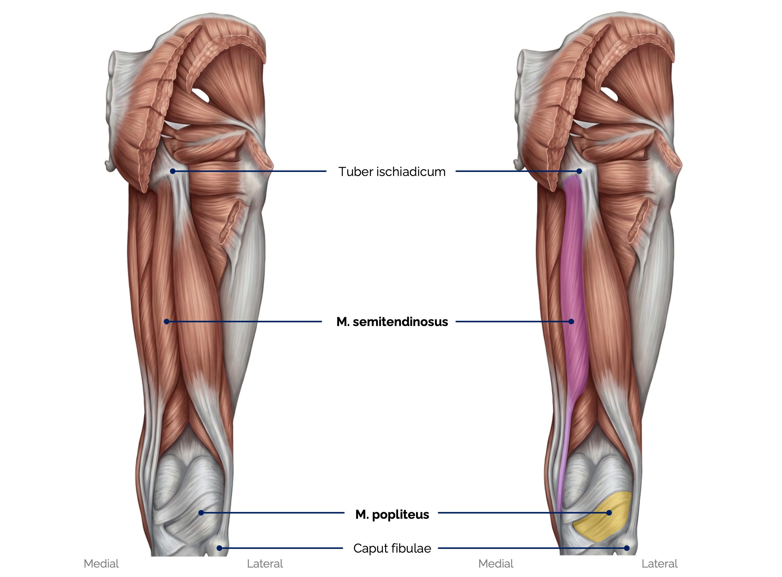 Dorsale Oberschenkelmuskeln