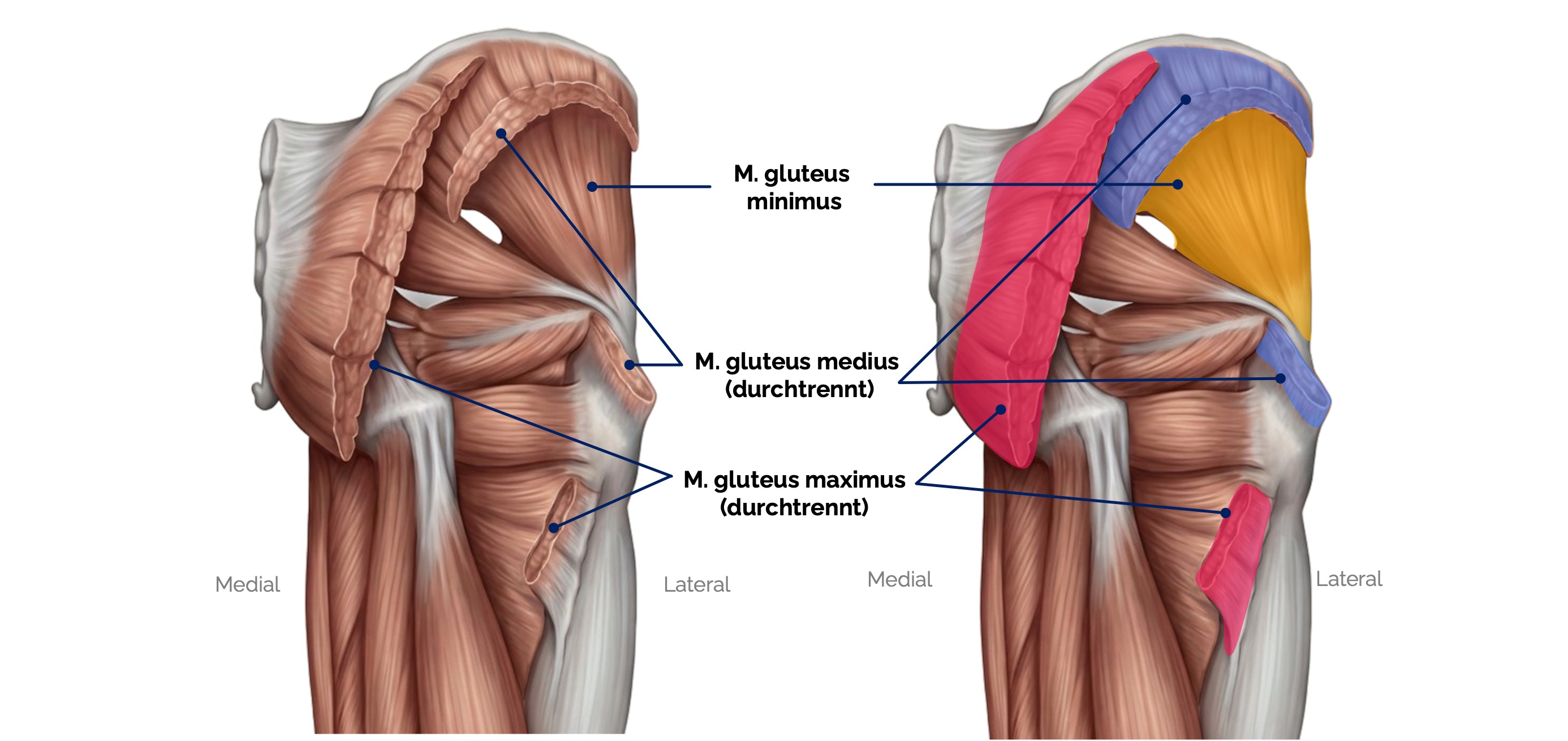 Äußere Hüftmuskulatur