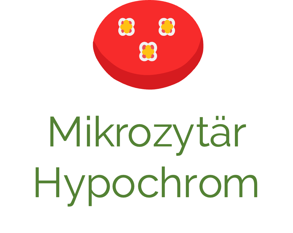 Mikrozytäre, hypochrome Anämie