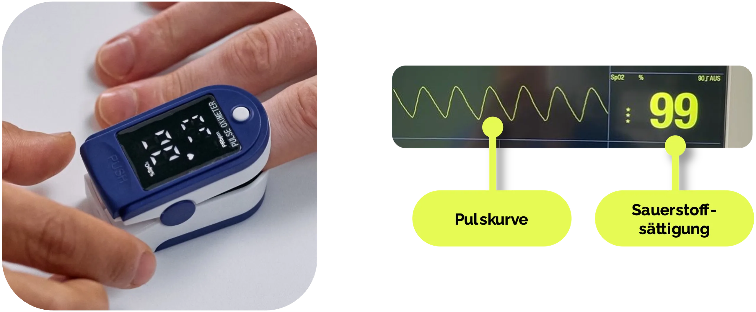 Pulsoxymetrie