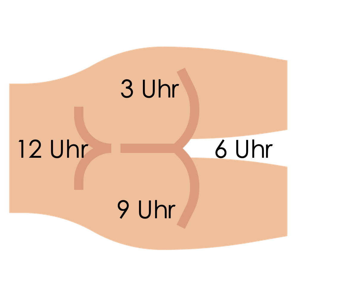 Lokalisation eines Befundes in Linksseitenlage