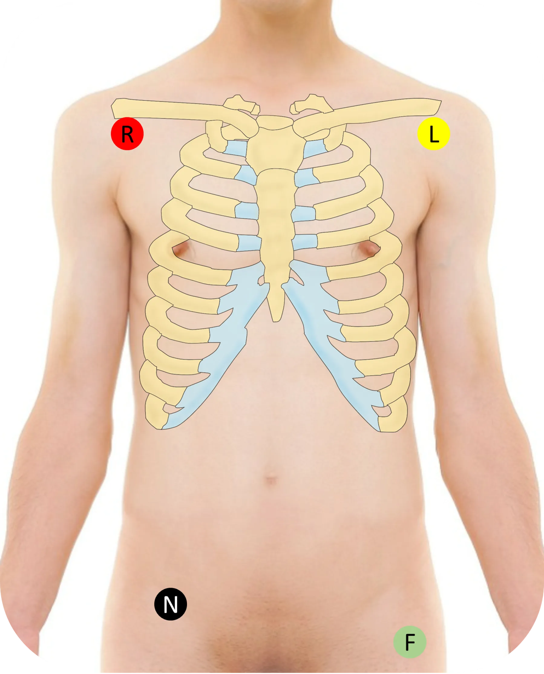 Lokalisationen der EKG-Elektroden