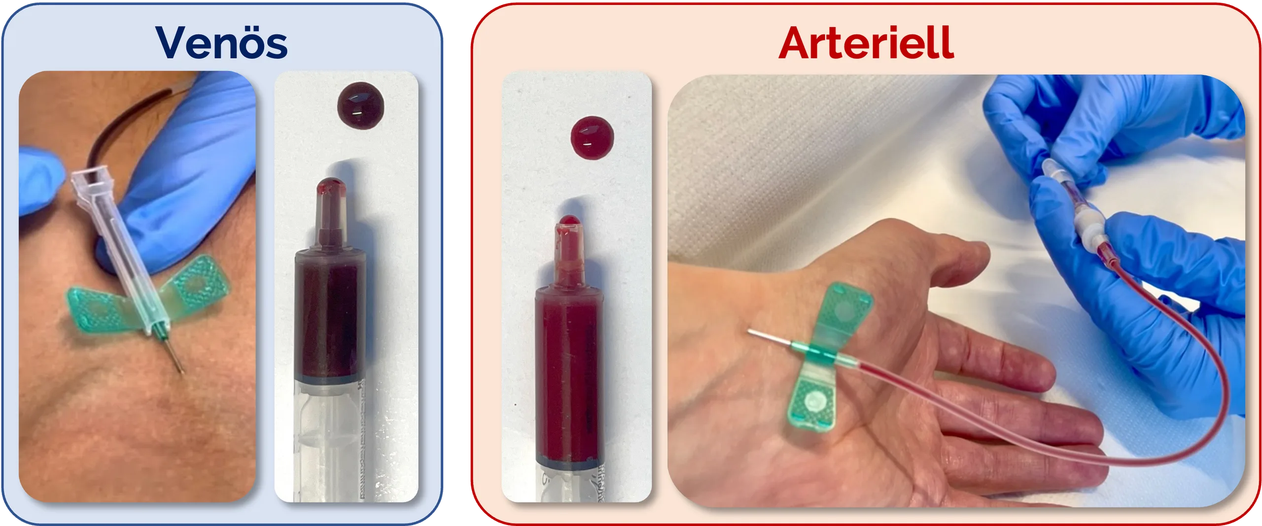 Unterscheidung von arteriellem oder venösem Blut