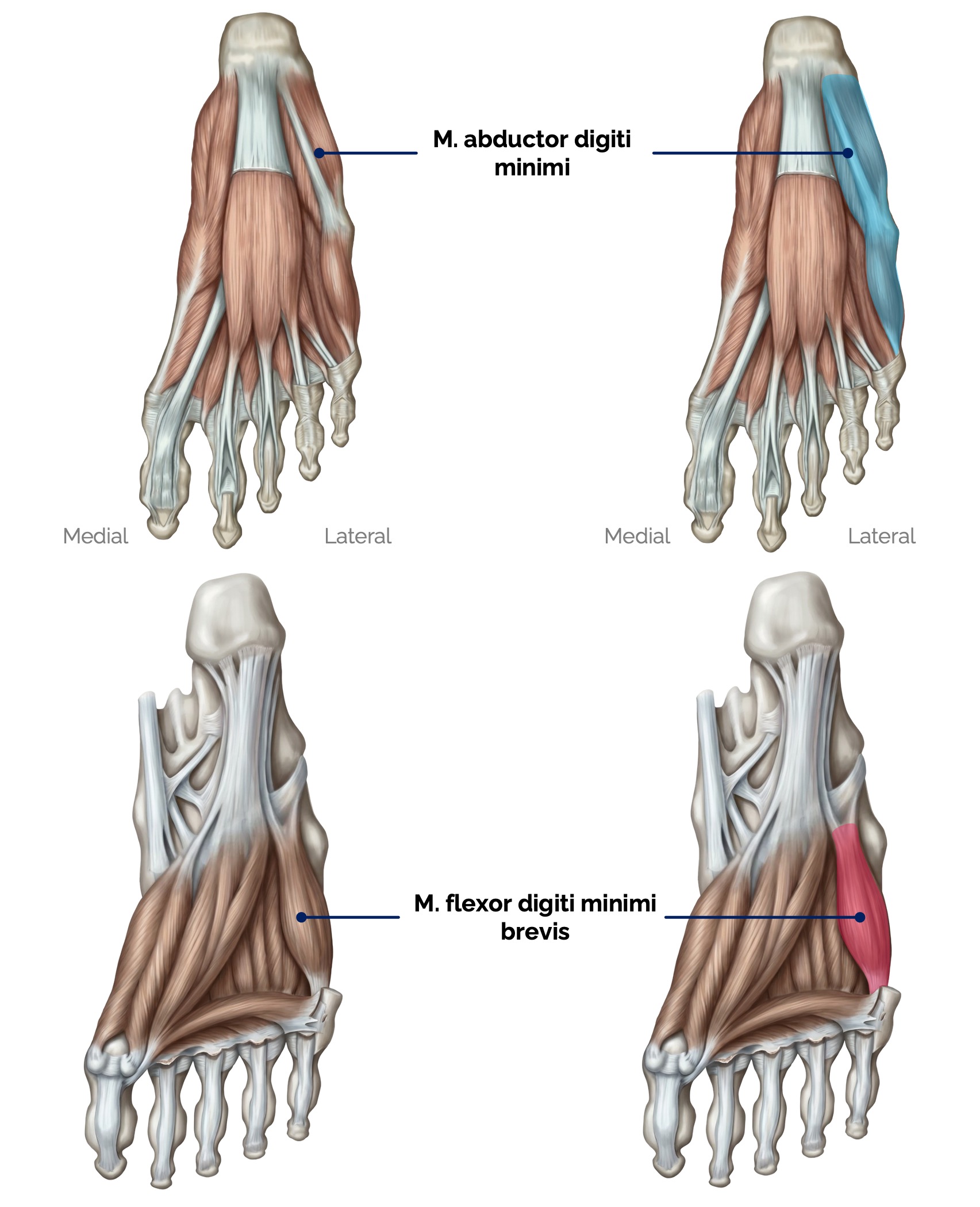 Fußmuskulatur (Kleinzehenloge)
