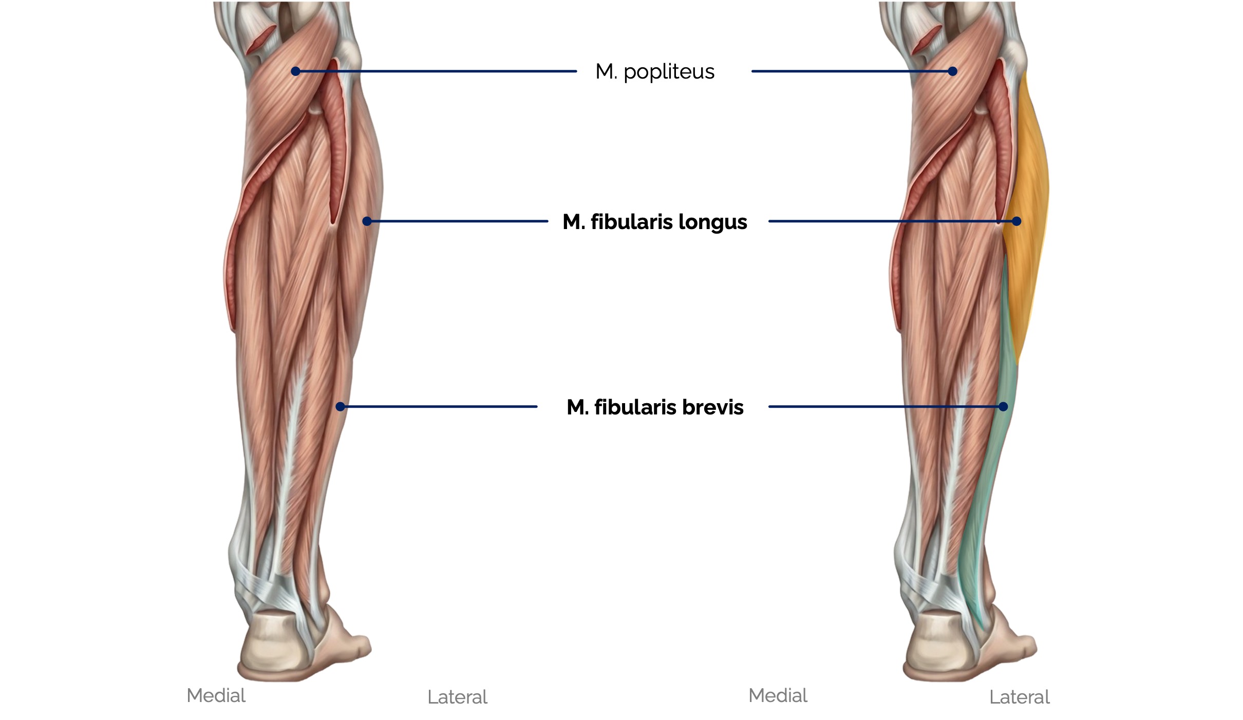 Laterale Unterschenkelmuskeln