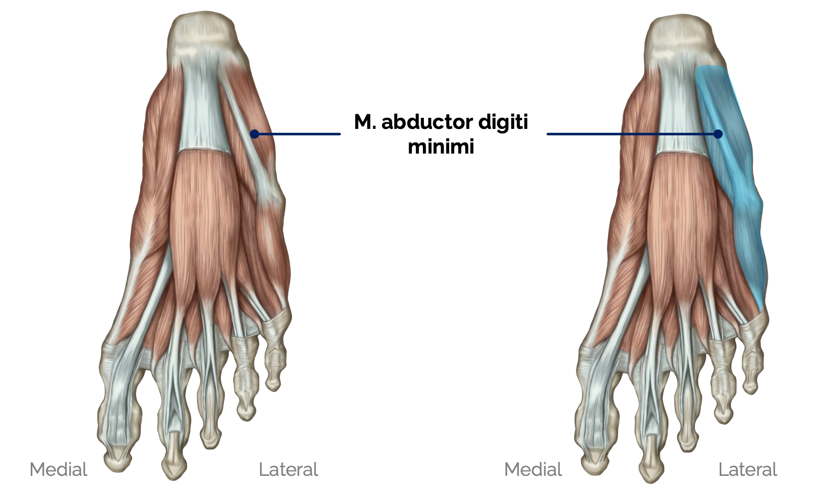 M. abductor digiti minimi des Fußes