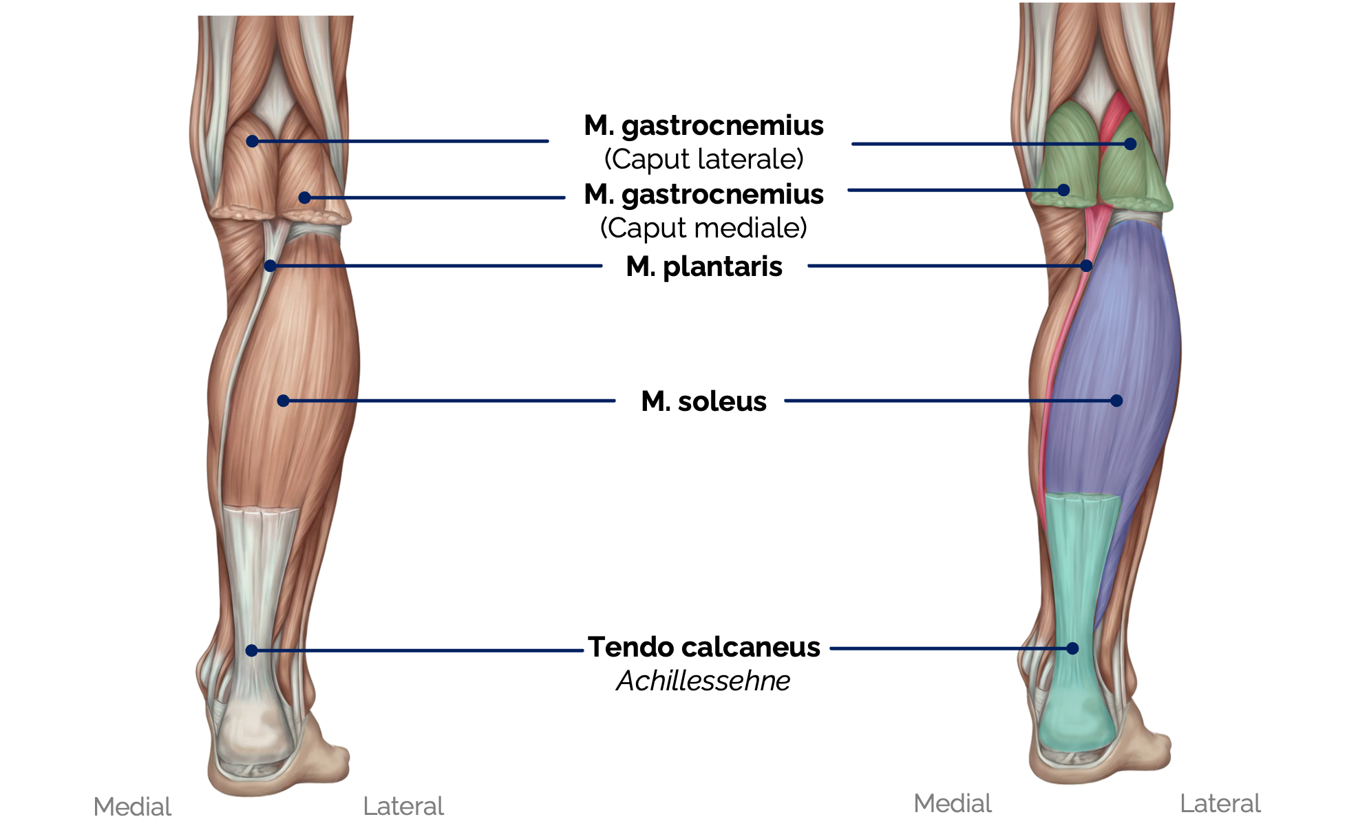M. gastrocnemius, M. plantaris und M. soleus (Triceps surae)