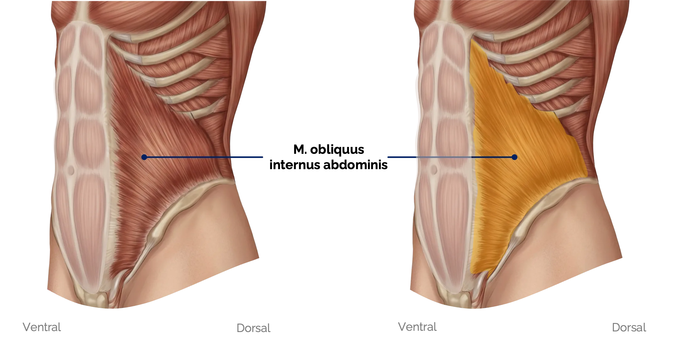 M. obliquus internus abdominis
