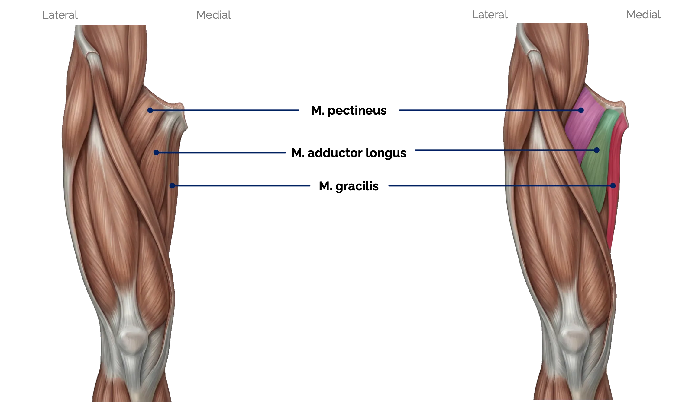 M. pectineus, M. adductor longus und M. gracilis