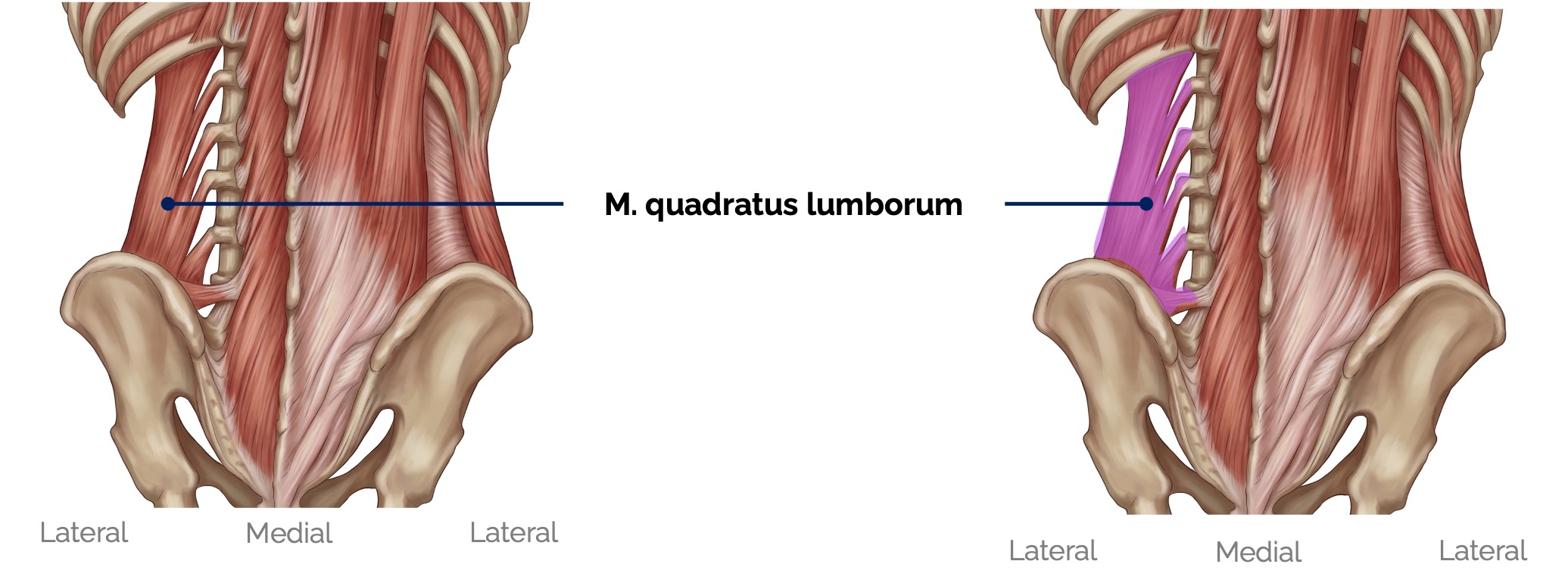 M. quadratus lumborum