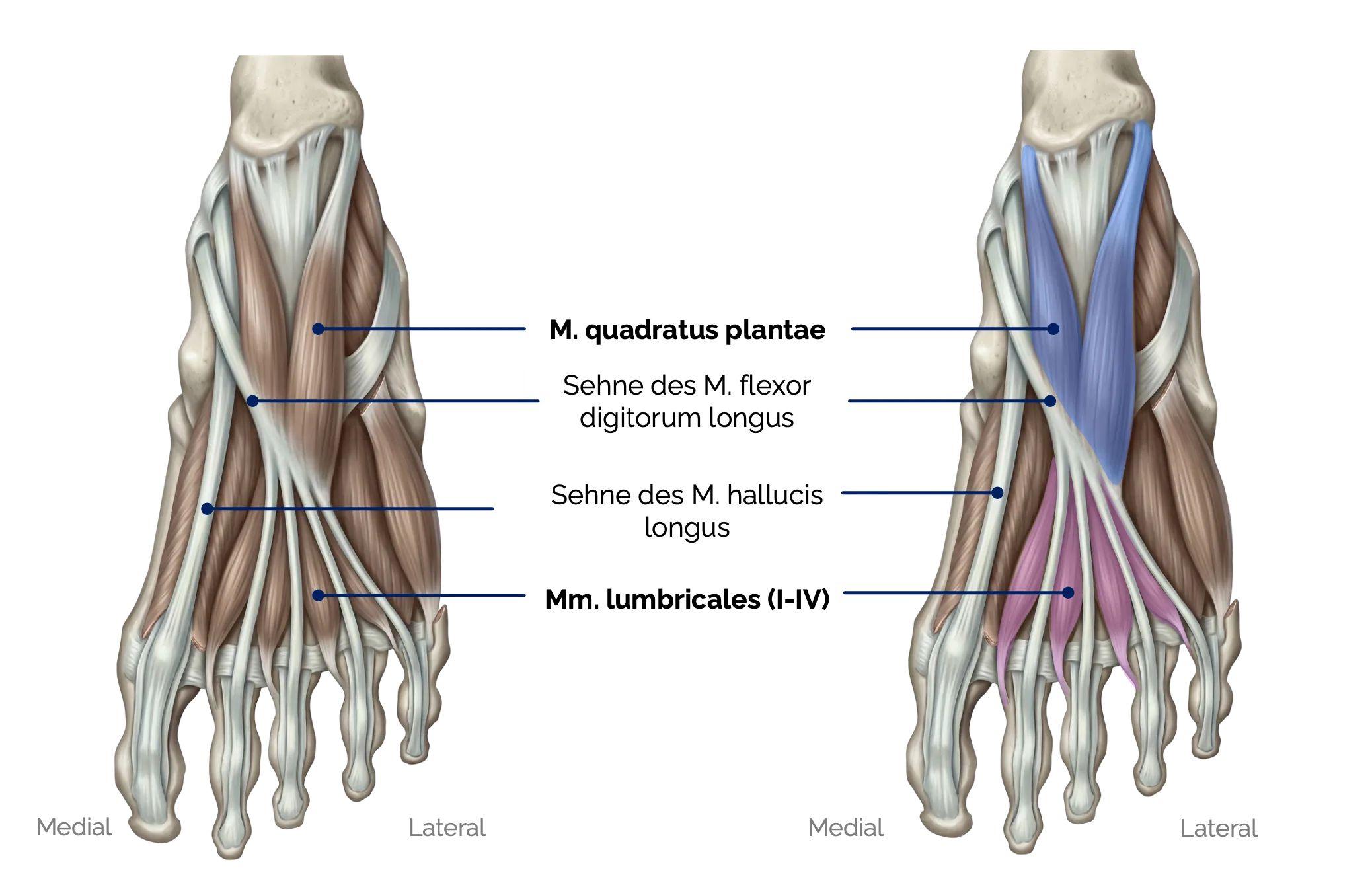 M. quadratus plantae und Mm. lumbricales