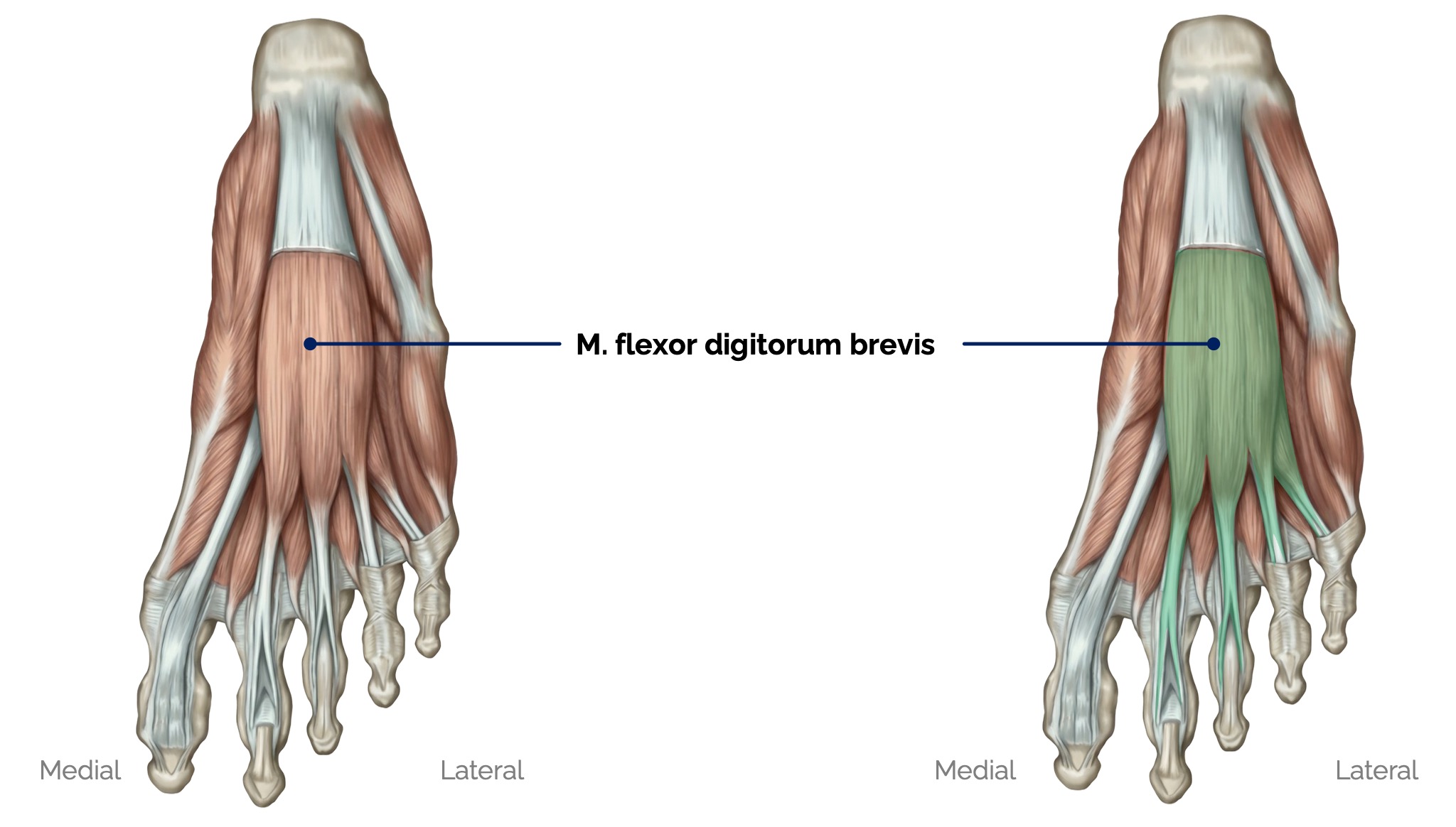Plantare Fußmuskulatur (Mittelloge)