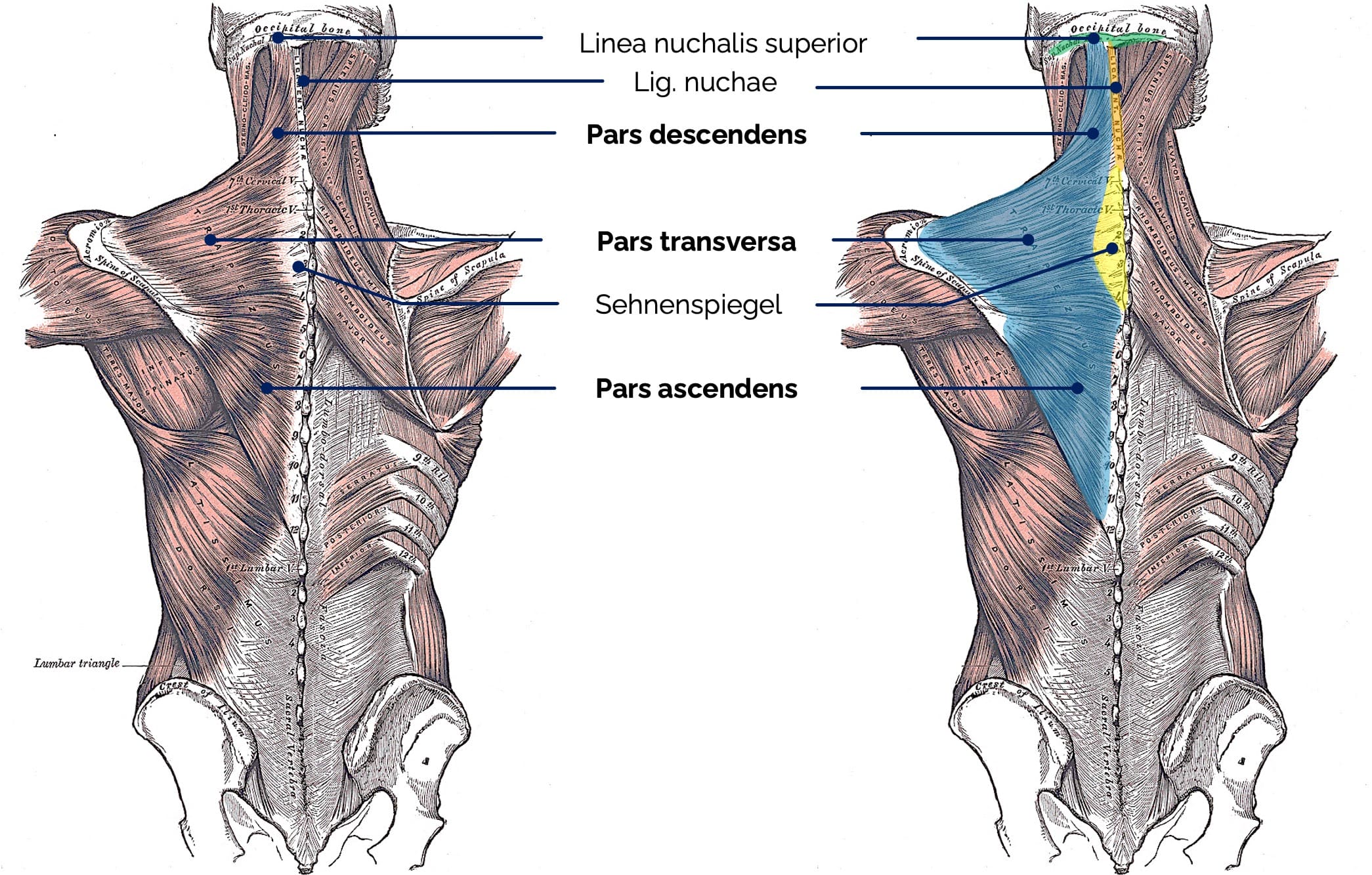 Musculus trapezius (Ansicht von dorsal)