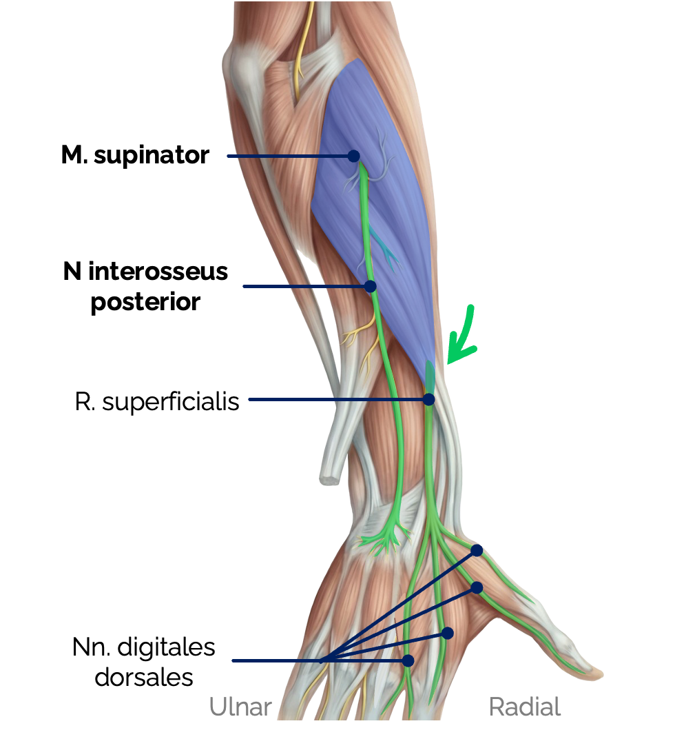 Verlauf des N. interosseus posterior