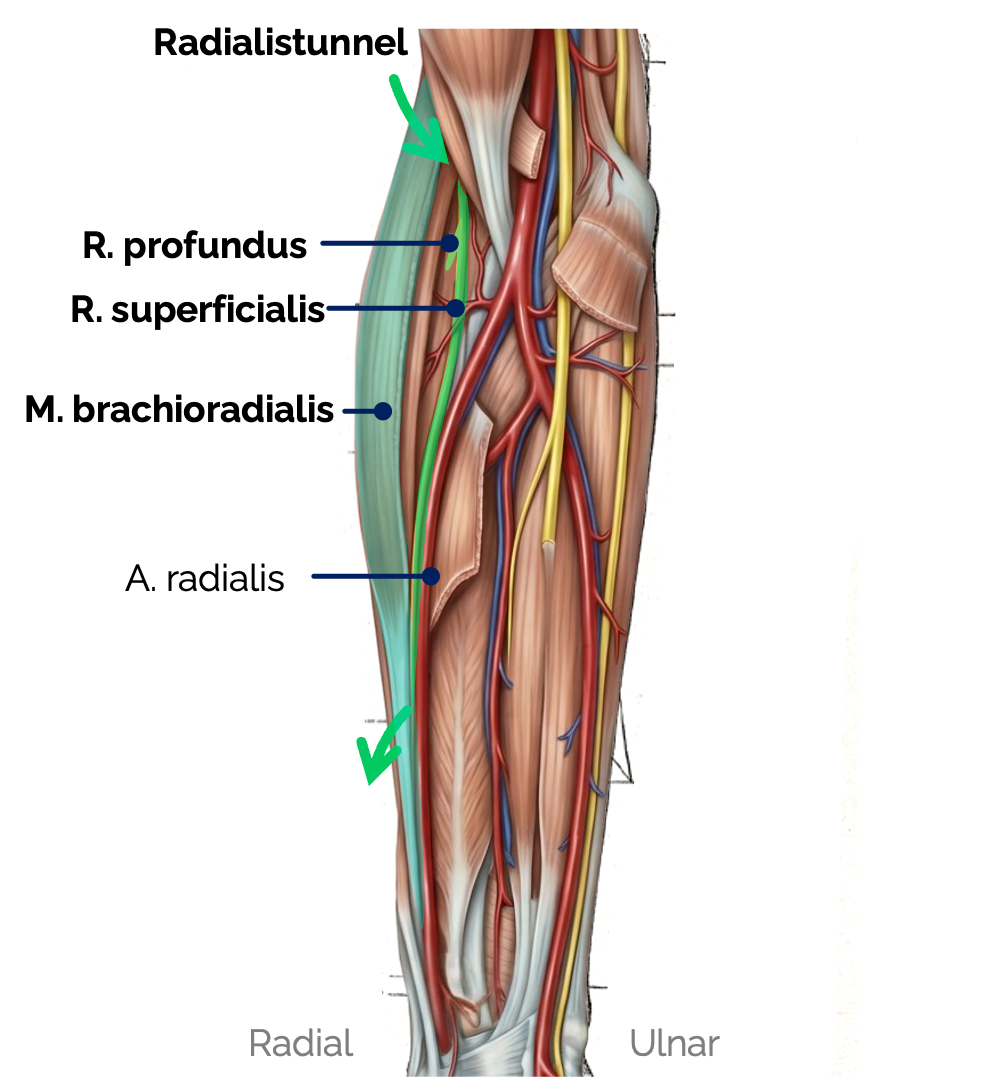 N. radialis im Radialistunnel